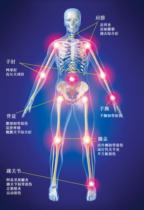 Shoulder: Frozen shoulder, Rotator cuff tear, Impingement syndrome, Elbow: Tennis elbow, Golf elbow, Wrist: Damaged wrist ligament, Pelvis: Damaged waist ligament, Pelvic pain, Sacroiliac joint syndrome, Knee: Internal (external) collateral ligament, Degenerative arthritis, Damaged patellar ligament, Damaged meniscus, Ankle: Achilles tendinitis, Damaged ankle ligament, Plantar fasciitis, Sports injury