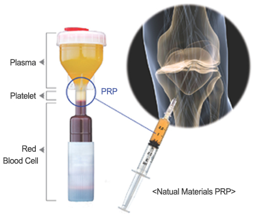 Plasma, Platelet, Red Blood Cell, PRP, Natural Materials PRP